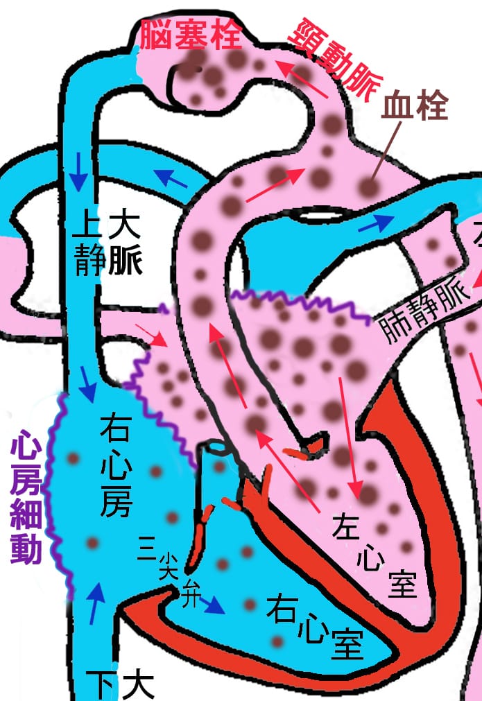 不整脈（心房細動・心室頻拍・期外収縮など）