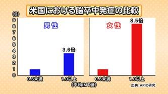 頸動脈エコー