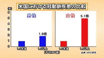 頸動脈エコー